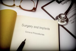 Maxillofacial surgeon implants surgery